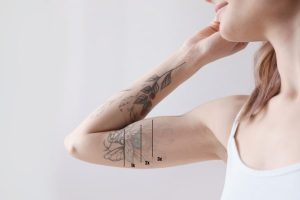 borrar tatuajes con láser q-switched