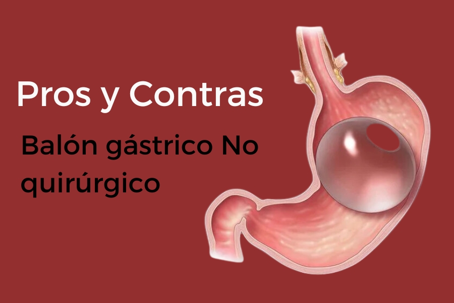 Ventajas y desventajas del balón
